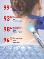 Advanced Laser Wart Remover Pen Quick Painless Home Wart Removal