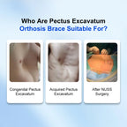 Pectus Excavatum Vacuum Bell Automatic Pump Sunken Chest Orthosis Brace