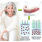 Immediate Dentures: Denture bases designed specifically for edentulous adults