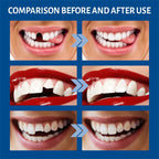 30ml Temporary Tooth Repair Kit Teeth And Gaps FalseTeeth Solid Glue Denture Adhesive Teeth Whitening Tooth Beauty Tool