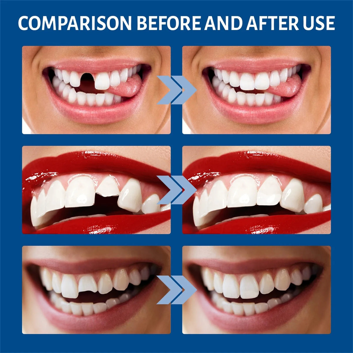 30ml Temporary Tooth Repair Kit Teeth And Gaps FalseTeeth Solid Glue Denture Adhesive Teeth Whitening Tooth Beauty Tool