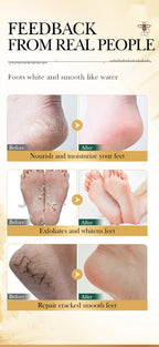 Vitamin E Foot Mask Manuka Honey Nourishing Long-lasting Moisturizing Hydrating Exfoliating Remove Dead Skin Foot Skin Care