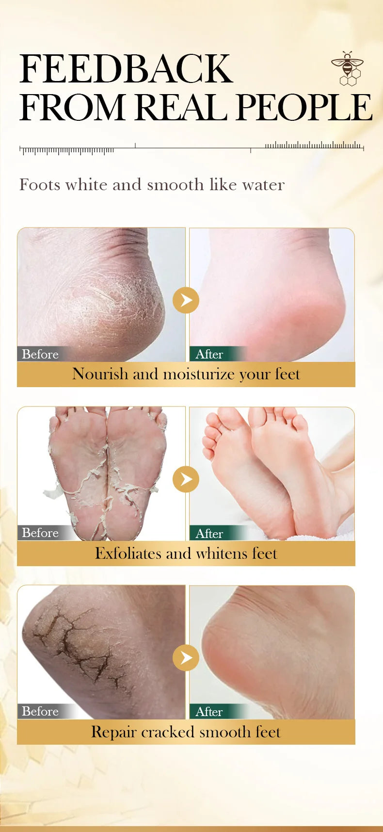 Vitamin E Foot Mask Manuka Honey Nourishing Long-lasting Moisturizing Hydrating Exfoliating Remove Dead Skin Foot Skin Care