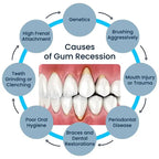 Gum Repair Care Gel Relieve Sore Gum Improve Gingival Damaged Inflammation Cleaning Teeth Stains Tartar Whitener Gum Protect Gel