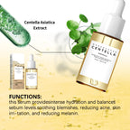 Centella Asiatica Brightening Serum: Calms Irritation, Reduces Breakouts, Balances Sebum & Diminishes Dark Marks for Clear Skin.
