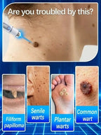 Professional Blue Light Skin Care Pen For Facial Smoothing And Glow