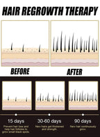2026  latest technology new products Anti-hair Loss Essence Promotes Hair Growth and Improves The Scalp Environment