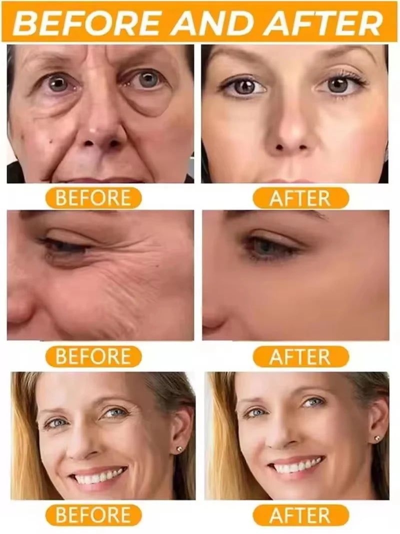 Instant Collagen Protein Threads Lifting Firming Absorbable Face Filler Anti-aging Deep Repair Fade Fine Lines Korean Skincare