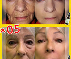 wrinkles disappear become beautiful now