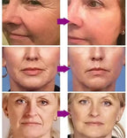 Instant Collagen Protein Threads Lifting Firming Absorbable Face Filler Anti-aging Deep Repair Fade Fine Lines Korean Skincare