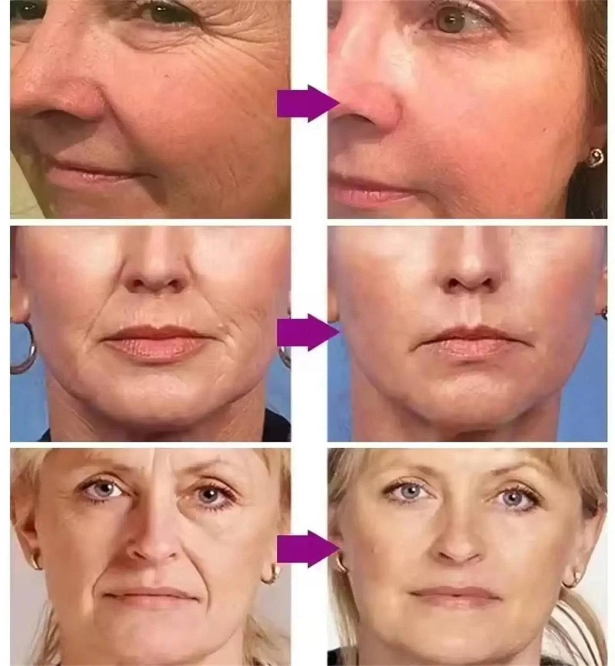 Instant Collagen Protein Threads Lifting Firming Absorbable Face Filler Anti-aging Deep Repair Fade Fine Lines Korean Skincare