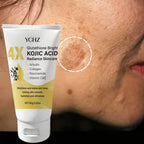 Kojic Acid Face Cream Evens Out Skin Tone, Eliminates Dark Spots and Dullness - Non-Greasy, Suitable for Both Men and Women - Whitening and Moisturizing Cream, for Day and Night Use