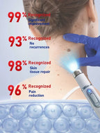 Professional Blue Light Skin Care Pen For Facial Smoothing And Glow