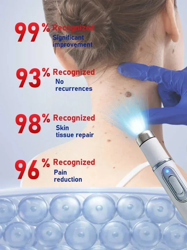 Professional Blue Light Skin Care Pen For Facial Smoothing And Glow