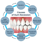 50ML Damaged Gum RepairCare Gel Serum Relieve Sore Gums Allergy Deep Cleaning Teeth Stains Tartar Serum Dental Caries Toothpaste