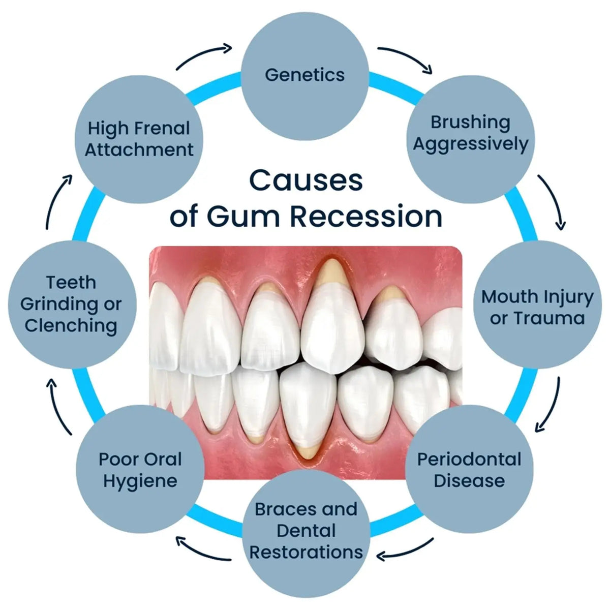 50ML Damaged Gum RepairCare Gel Serum Relieve Sore Gums Allergy Deep Cleaning Teeth Stains Tartar Serum Dental Caries Toothpaste