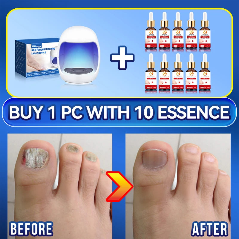 2025 Hot selling Generation-2，Rejuvenator - Fungus Prevention Technology - Adjustable Control & Safety Sensor,unisex