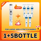 2026 New Blue Light Pen to Solve Body Stretch Marks, Postpartum Skincare Tools