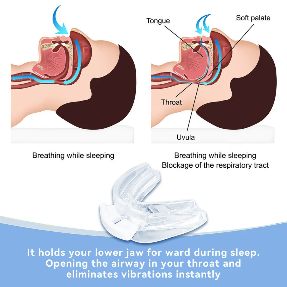 Adjustable Anti Snoring Mouth Guard Dental Sleep Aid For Comfortable Rest
