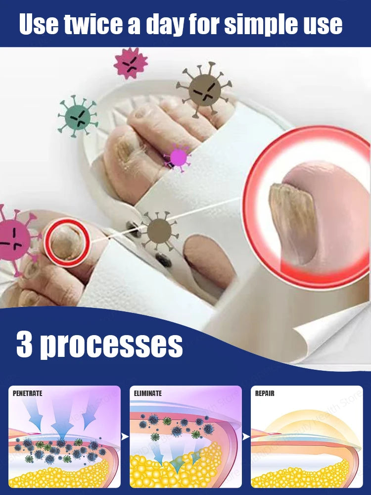 2025 Hot selling Generation-2，Rejuvenator - Fungus Prevention Technology - Adjustable Control & Safety Sensor,unisex