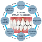 Gum Repair Care Gel Relieve Sore Gum Improve Gingival Damaged Inflammation Cleaning Teeth Stains Tartar Whitener Gum Protect Gel