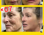 wrinkles disappear become beautiful now
