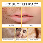 30ml Vitamin C Brightening Serum with Turmeric Extract Niacinamide Face Moisturizer Hydrating Glow Booster for Even Skin Tone