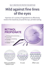 O'CHEAL Anti Wrinkle Anti Dark Circle Eye Cream Roller Massager Moisturizing Eye Bags Anti Aging Hyaluronic Acid Eye Skin Care