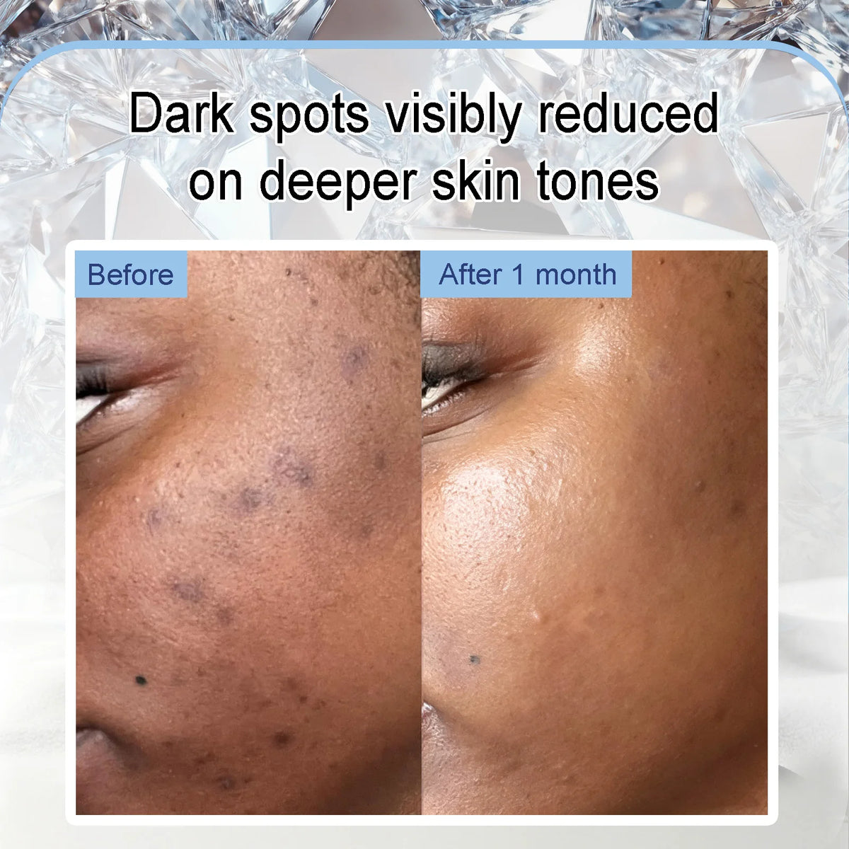 WK JALY Dark Spot Correcting Day and Night Serum, With Turmeric, Vitamin C, Moisturizing, Lightening, Even Skin Tone Essence