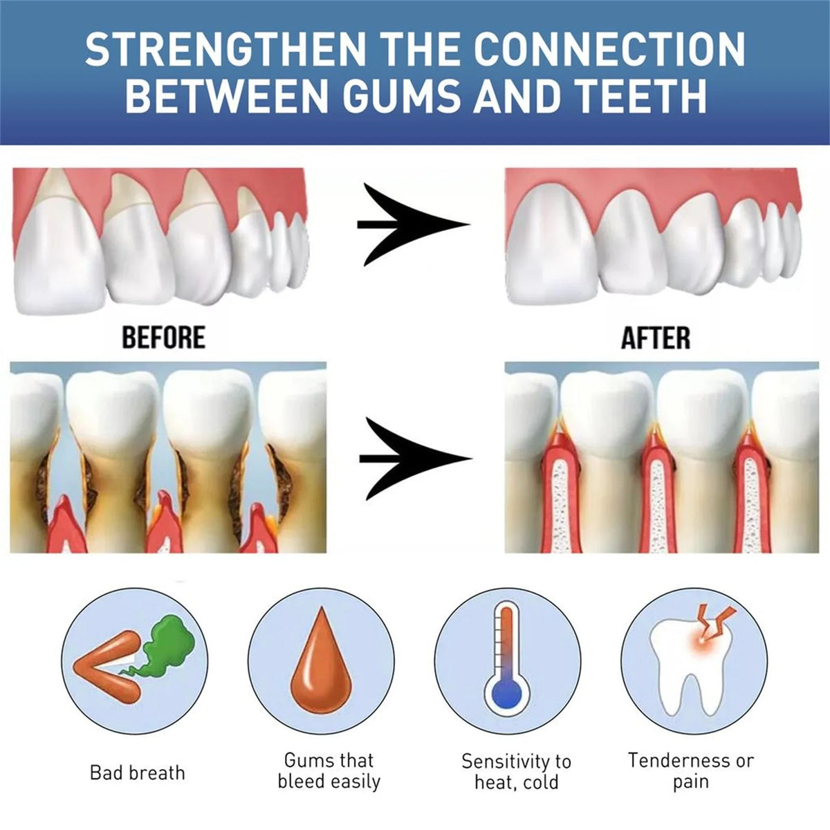 50ML Damaged Gum RepairCare Gel Serum Relieve Sore Gums Allergy Deep Cleaning Teeth Stains Tartar Serum Dental Caries Toothpaste