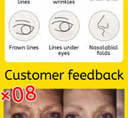 wrinkles disappear become beautiful now