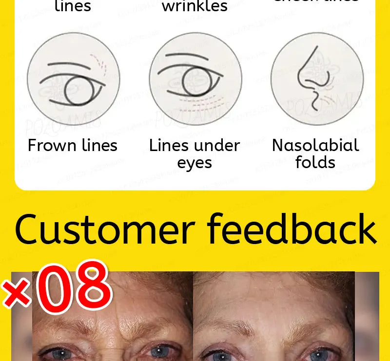 wrinkles disappear become beautiful now