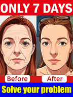 Upgraded version, No fine lines Says Goodbye To Your Troubled In 7 Days