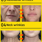 wrinkles disappear become beautiful now