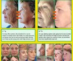 wrinkles disappear become beautiful now