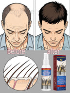 Advanced Hair Growth Serum With Natural Scalp Nourishment And Root Support