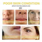 Instant Collagen Protein Threads Lifting Firming Absorbable Face Filler Anti-aging Deep Repair Fade Fine Lines Korean Skincare
