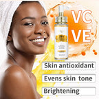 AILKE Vitamin C and E Brightening Concentrated Serum, Whitening, Moisturizing, Clean Skin, Reduce Dark Spots, 100ml/3.52 oz