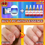 2025 Hot selling Generation-2，Rejuvenator - Fungus Prevention Technology - Adjustable Control & Safety Sensor,unisex