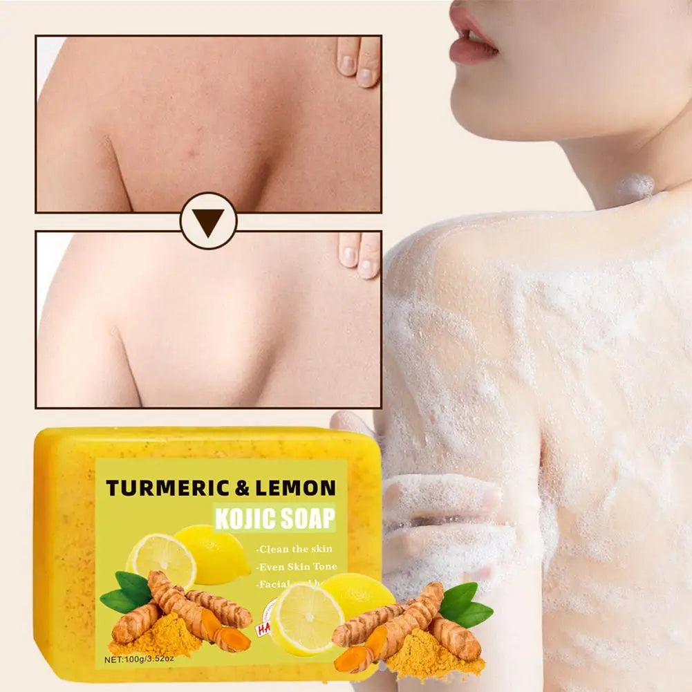 Turmeric Kojic Acid Lemon Soap Bar, Soap Bar Brighten Even Skin Vitamin E, Gentle Lemon Soap For Face,Body Wash