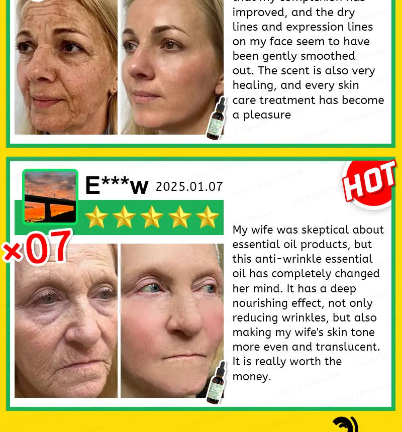 wrinkles disappear become beautiful now