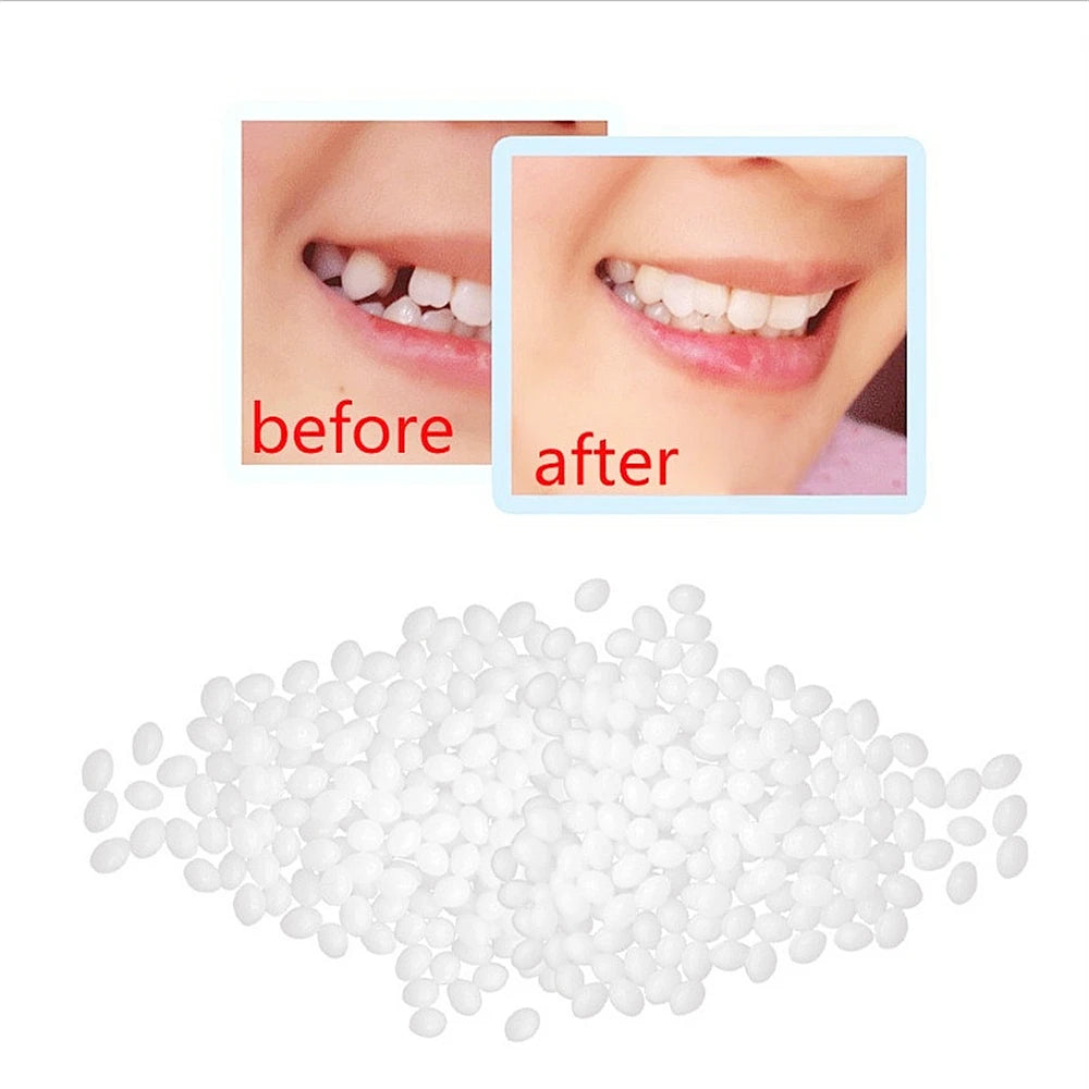 10g/Bag Tooth Repair Kit-Thermal Beads for Filling Fix The Missing and Broken Tooth or Adhesive The Denture Fake Teeth