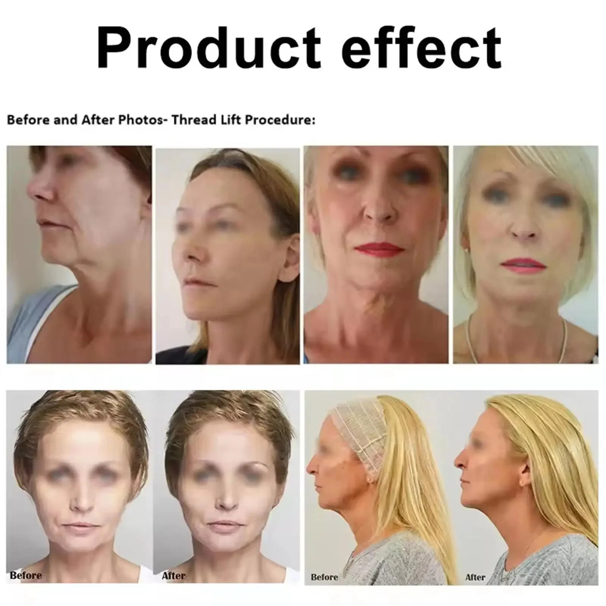 Instant Collagen Protein Threads Lifting Firming Absorbable Face Filler Anti-aging Deep Repair Fade Fine Lines Korean Skincare