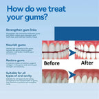 50ML Damaged Gum RepairCare Gel Serum Relieve Sore Gums Allergy Deep Cleaning Teeth Stains Tartar Serum Dental Caries Toothpaste
