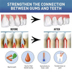 Gum Repair Care Gel Relieve Sore Gum Improve Gingival Damaged Inflammation Cleaning Teeth Stains Tartar Whitener Gum Protect Gel