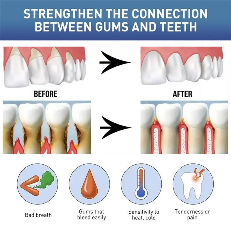 Gum Repair Care Gel Relieve Sore Gum Improve Gingival Damaged Inflammation Cleaning Teeth Stains Tartar Whitener Gum Protect Gel