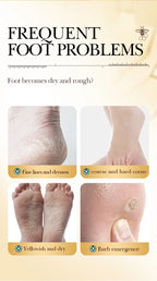 Vitamin E Foot Mask Manuka Honey Nourishing Long-lasting Moisturizing Hydrating Exfoliating Remove Dead Skin Foot Skin Care