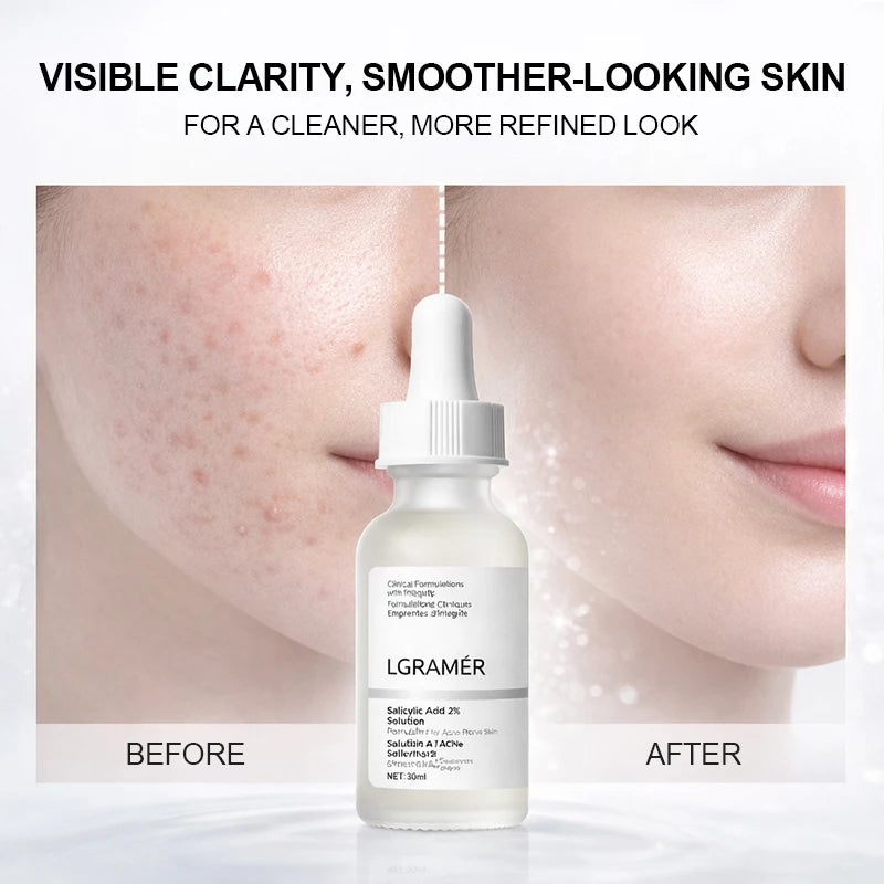 2% Salicylic Acid Facial Serum, Anti-Acne Essence for Troubled Skin, Deep Hydrating & Pore Cleansing Daily Facial Skin Care
