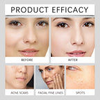 HOYGI Vitamin C Serum Cream Whiten Brightening Skin Tone Lighten Dark Spots Melasma Repair Hydrating Fast Absorbing Skin Care