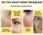 Instant Collagen Protein Threads Lifting Firming Absorbable Face Filler Anti-aging Deep Repair Fade Fine Lines Korean Skincare